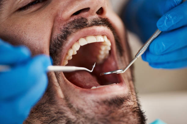 Best Emergency Denture Repair in Rothsville, PA